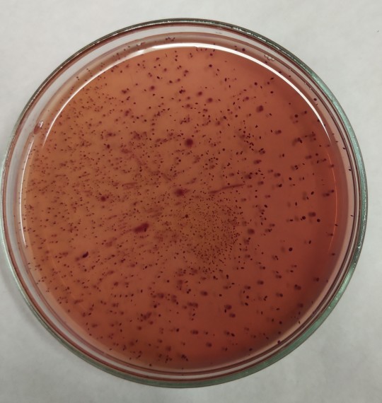 16. Enterobacteraceae na VČŽG