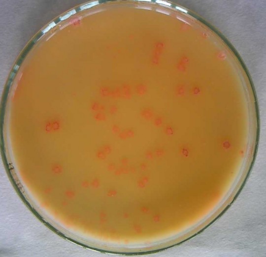19. Jogurtová kultura na LS mediu