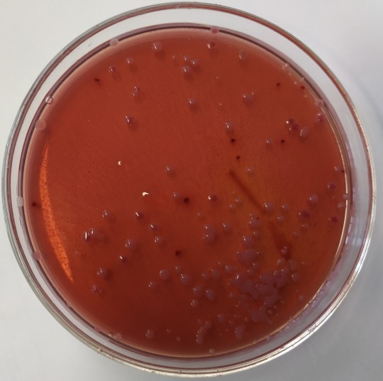 20. Koliformní bakterie na VČŽL.