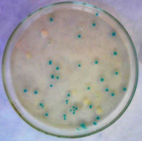 26. Růst na HiE.coli agaru