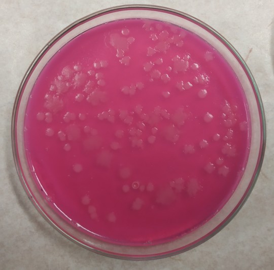 29. Růst Bacillus cereus na MYP