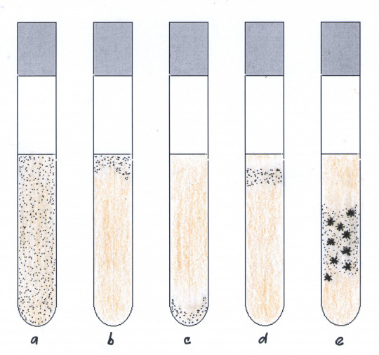 15. Růst v tekuté živné půdě: a) zákal, b) růst ve svrchní vrstvě, c) sediment, d) růst pod svrchní vrstvou, e) tvorba hrubých vloček