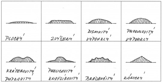 19. Profil bakteriálních kolonií