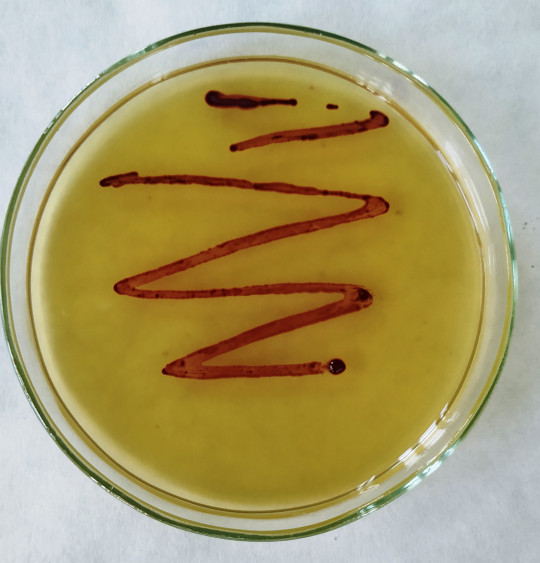 36. Typické kolonie na SBA