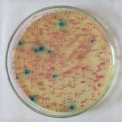 17. Escherichia coli na živné půdě Chromocult