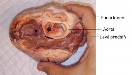 26. Srdce prasete, srdeční báze