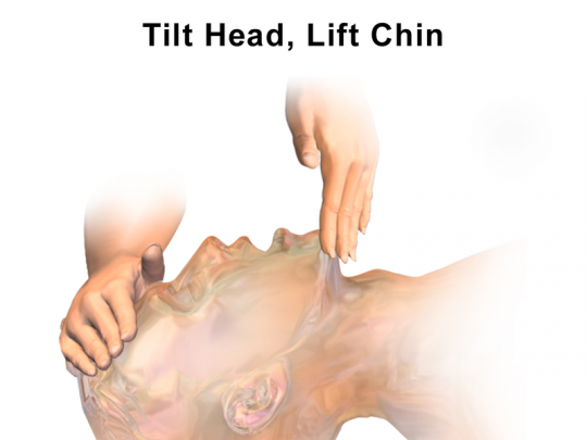 12. Head tilt