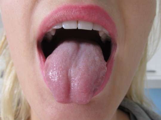 2. Tongue