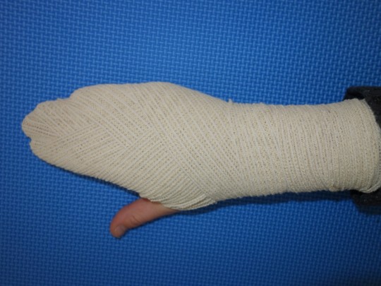 10. Zhotovení obvazu – „Pacička 1“