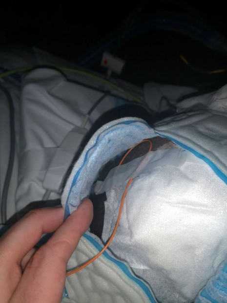 25. Zavedené intrakraniální čidlo