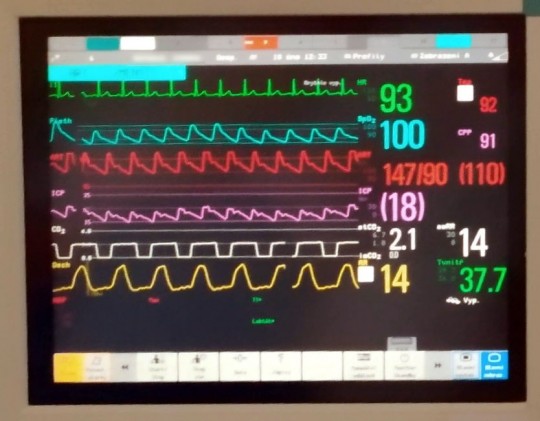 28. Pacientský monitor