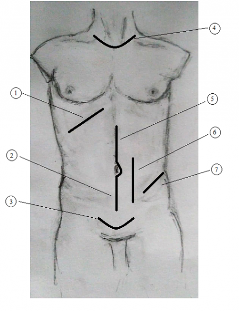 1. šikmá laparotomie v podžebří – Kehrův řez, 2. dolní střední laparotomie, 3. Pfannensttielův řez (příčná suprapubická laparotomie), 4. kolární (límcový) řez, 5. horní střední laparotomie, 6. pararektální laparotomie, 7. lumbotomie [2]
