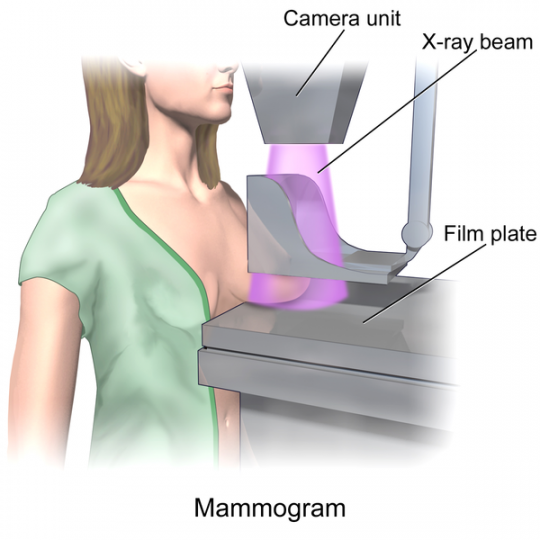 1. Mamograf