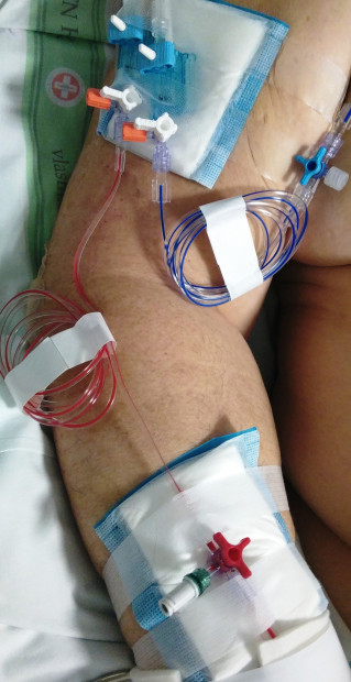 9. Měření tlaku krve a CVT