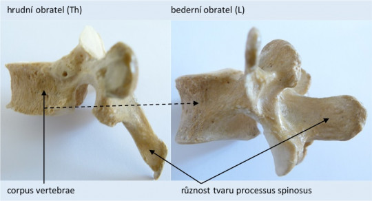 13. Hrudní a bederní obratel
