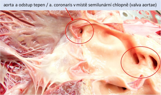 63. Odstup cév z počátečního úseku aorty – detail