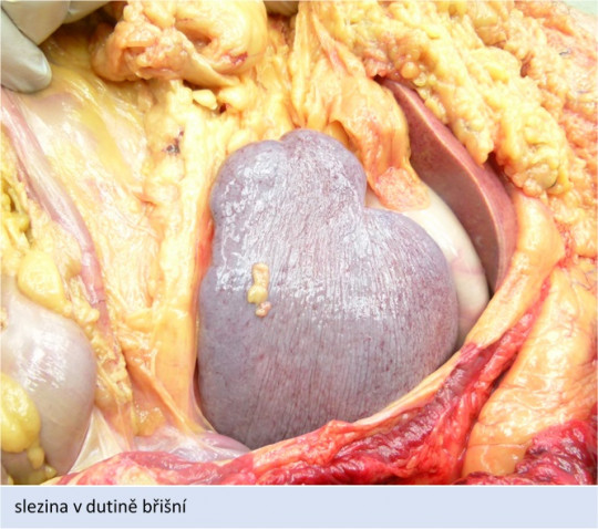 68. Slezina v dutině břišní