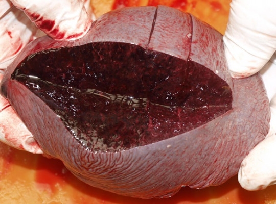 70. Slezina na řezu