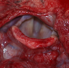 76. Pohled do hrtanu