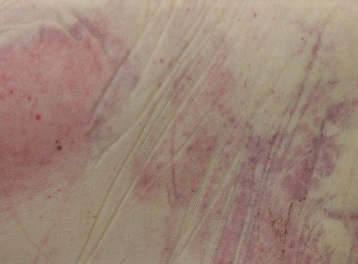 2. Posmrtné skvrny (1).