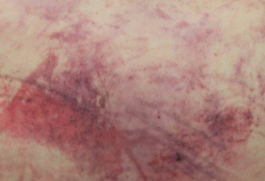 3. Posmrtné skvrny (2).