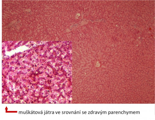 26. Muškátová játra.