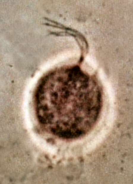 4. Bičenka poševní (Trichomonas vaginalis)