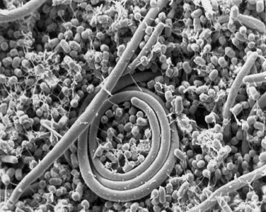 14. Salmonella enteritidis