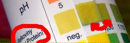 8. Bílkovina v moči