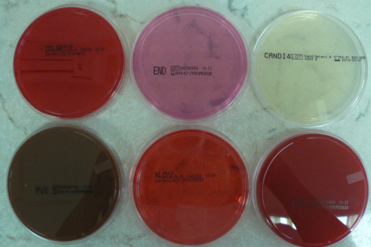 9. Agarové kultivační půdy