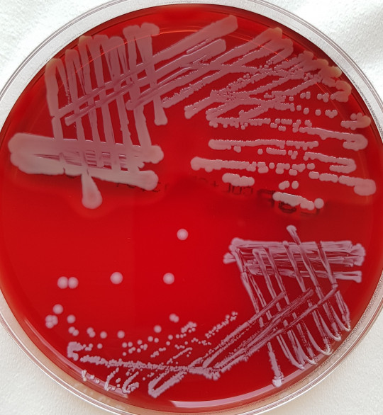 10. Křížový roztěr