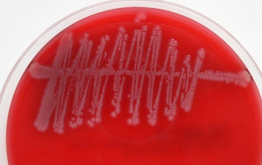 11. Semikvantitativní kultivace moče