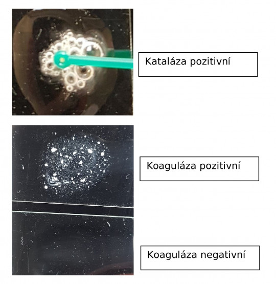 12. Kataláza, koaguláza