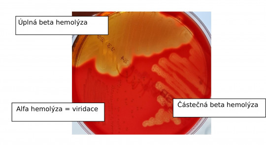 14. Typy hemolýzy