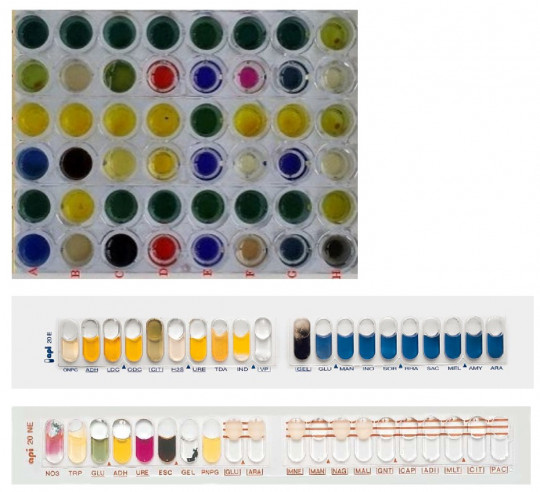 16. Komerční identifikační mikrotesty