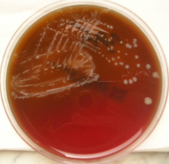 6. Clostridium perfringens na kultivační půdě