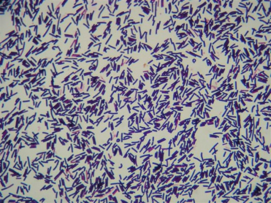 7. Clostridium perfringens mikroskopický preparát barvený dle Grama