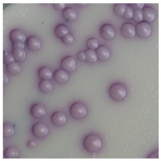 8. Kvasinky na kultivační půdě chromogenní agar