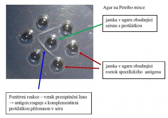20. Test dvojité difuze podle Ouchterlonyho