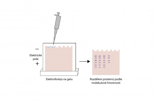 21. Elektroforéza