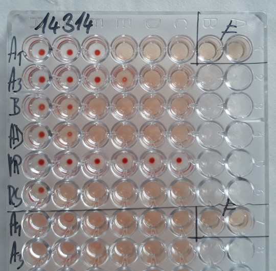 23. Komplement fixační reakce