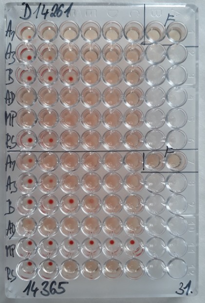 24. Komplement fixační reakce - sérokonverze
