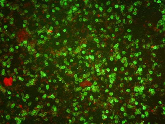 26. Přímá imunofluorescence, průkaz antigenu viru Herpes simplex typ 1