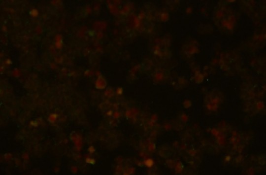 28. Nepřímá imunofluorescence, negativní průkaz protilátek proti antigenu VCA (virový kapsidový antigen) viru Epstein-Barrové