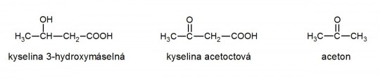 17. Ketolátky: kyselina 3-hydroxymáselná, kyselina acetoctová a aceton