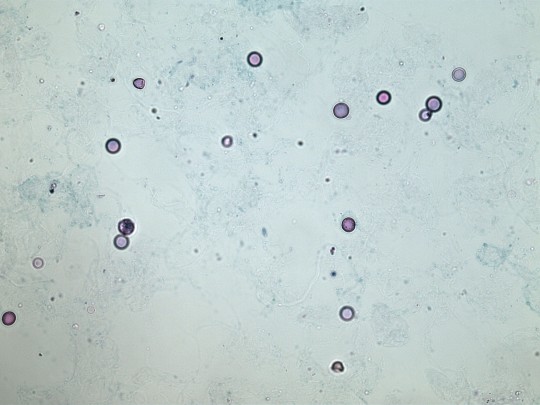 22. Erytrocyty (foto Ing. Ivana Hupáková, ÚKBH Plzeň)