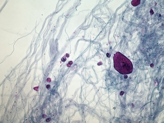 23. Leukocyty, hlen (foto Ing. Ivana Hupáková, ÚKBH Plzeň)