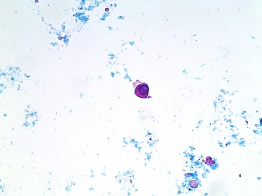 24. Renální tubulární epitelie (foto Ing. Ivana Hupáková, ÚKBH Plzeň)