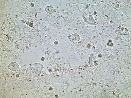 25. Přechodné epitelie (foto Ing. Ivana Hupáková, ÚKBH Plzeň)