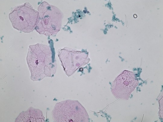 26. Dlaždicové epitelie (foto Ing. Ivana Hupáková, ÚKBH Plzeň)